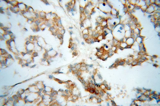 QDPR Antibody in Immunohistochemistry (Paraffin) (IHC (P))