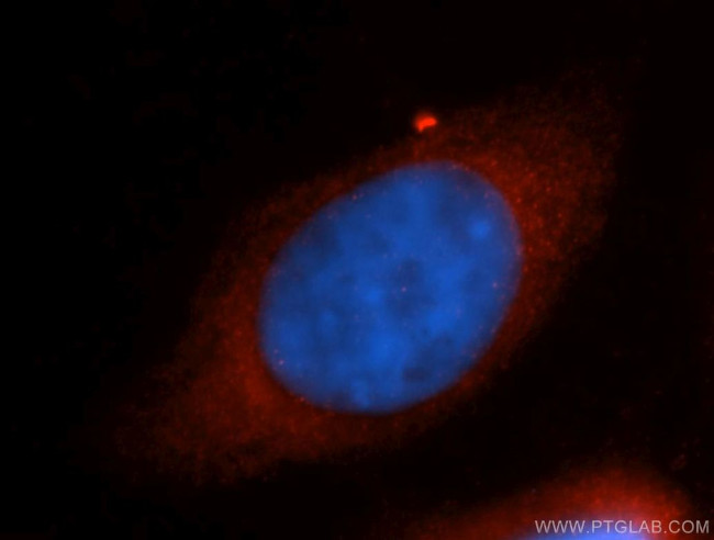 RPS26 Antibody in Immunocytochemistry (ICC/IF)