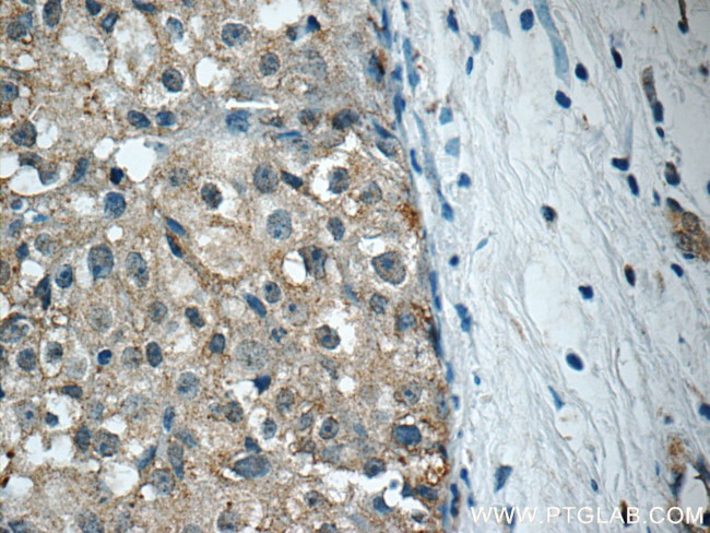 RPS26 Antibody in Immunohistochemistry (Paraffin) (IHC (P))