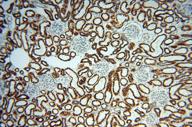 NDUFB7 Antibody in Immunohistochemistry (Paraffin) (IHC (P))