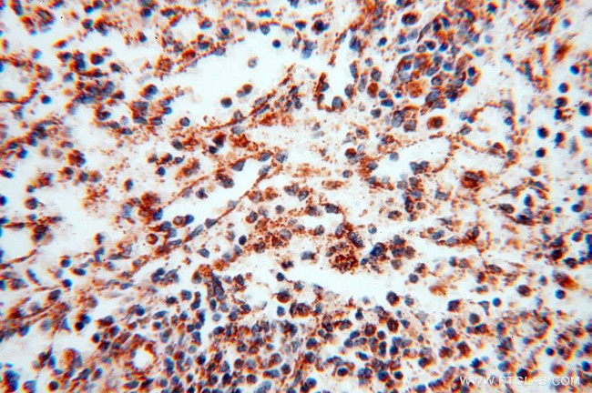 NDUFB7 Antibody in Immunohistochemistry (Paraffin) (IHC (P))