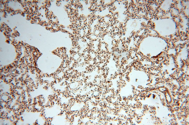 NDUFB7 Antibody in Immunohistochemistry (Paraffin) (IHC (P))