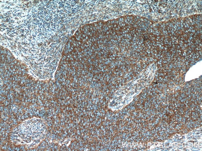 NDUFB7 Antibody in Immunohistochemistry (Paraffin) (IHC (P))