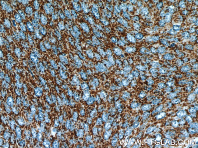 NDUFB7 Antibody in Immunohistochemistry (Paraffin) (IHC (P))