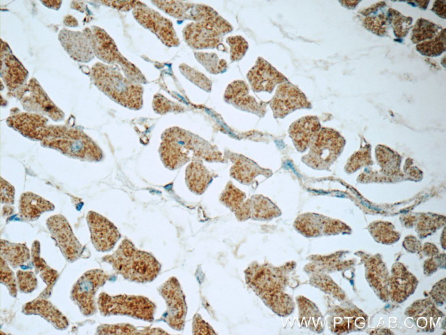 NDUFB7 Antibody in Immunohistochemistry (Paraffin) (IHC (P))