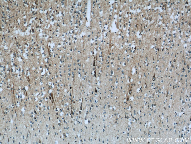 NDUFB7 Antibody in Immunohistochemistry (Paraffin) (IHC (P))