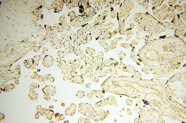 NDUFB7 Antibody in Immunohistochemistry (Paraffin) (IHC (P))