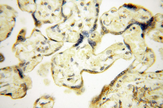 NDUFB7 Antibody in Immunohistochemistry (Paraffin) (IHC (P))