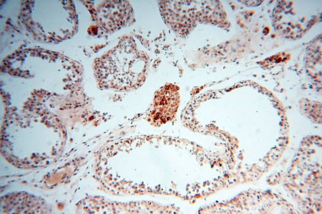 NDUFB7 Antibody in Immunohistochemistry (Paraffin) (IHC (P))