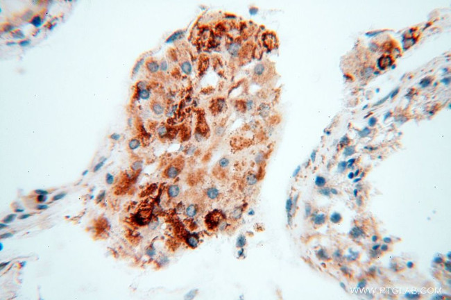 NDUFB7 Antibody in Immunohistochemistry (Paraffin) (IHC (P))