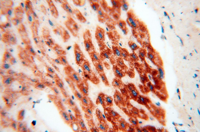 NDUFB7 Antibody in Immunohistochemistry (Paraffin) (IHC (P))