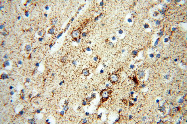 NDUFB7 Antibody in Immunohistochemistry (Paraffin) (IHC (P))