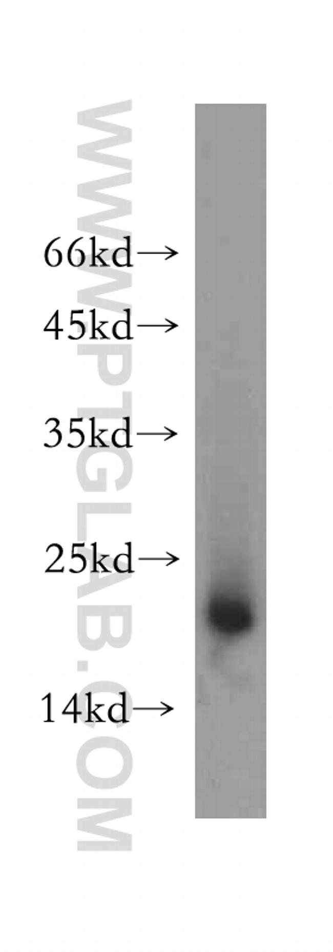 NDUFB7 Antibody in Western Blot (WB)