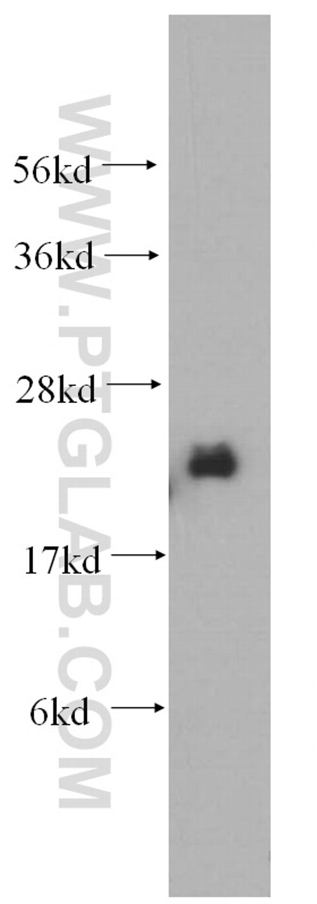 NDUFB7 Antibody in Western Blot (WB)