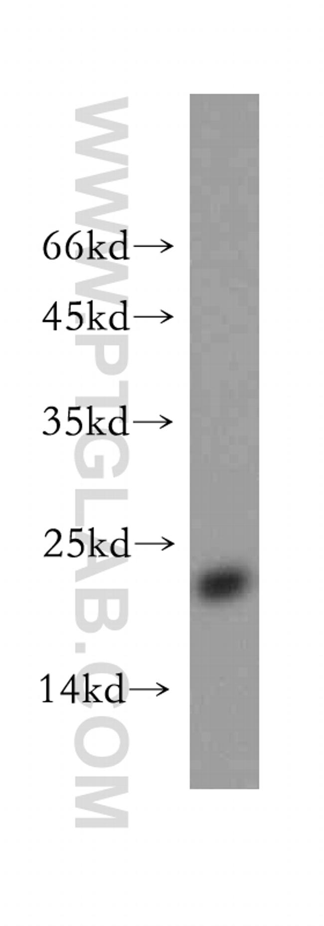 NDUFB7 Antibody in Western Blot (WB)