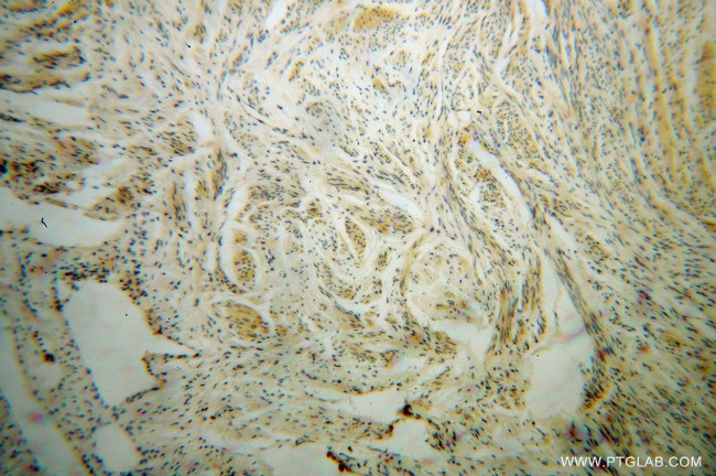 UROS Antibody in Immunohistochemistry (Paraffin) (IHC (P))