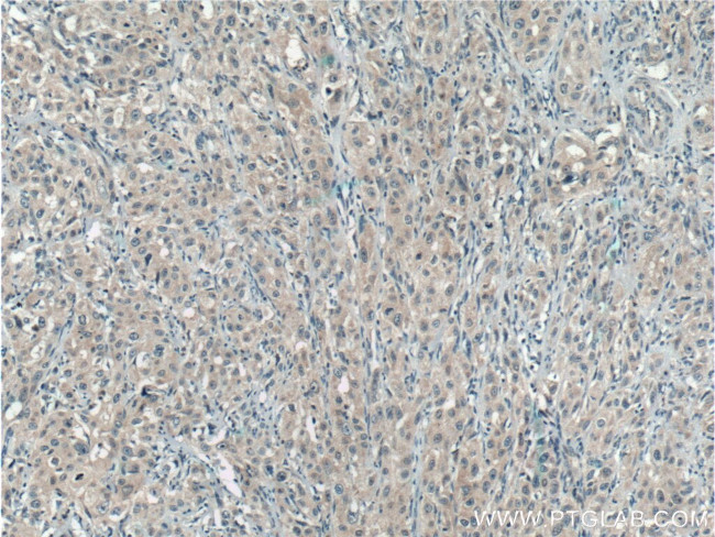 UROS Antibody in Immunohistochemistry (Paraffin) (IHC (P))