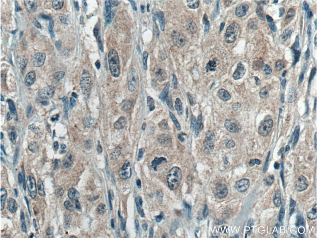 UROS Antibody in Immunohistochemistry (Paraffin) (IHC (P))