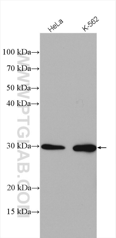 UROS Antibody in Western Blot (WB)