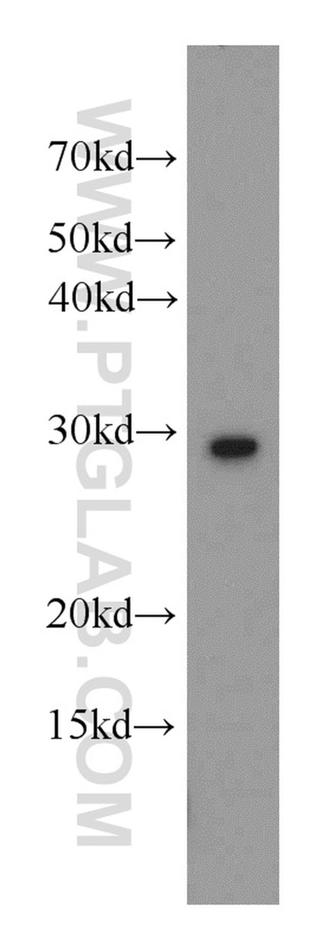 UROS Antibody in Western Blot (WB)