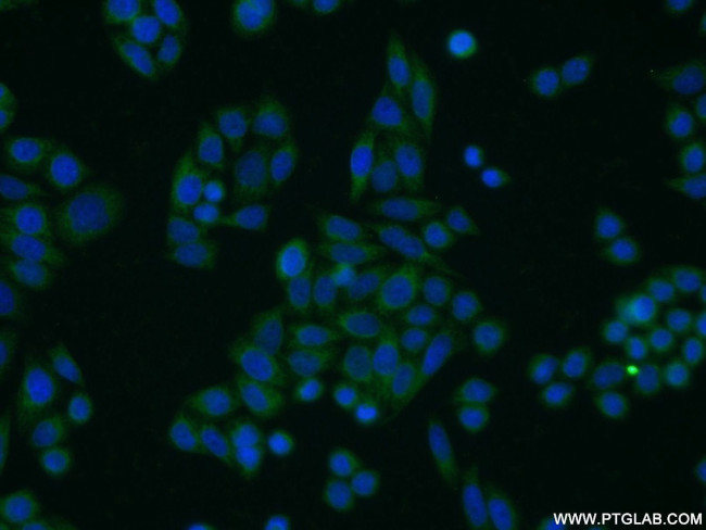 TOB1 Antibody in Immunocytochemistry (ICC/IF)