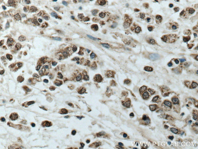 TOB1 Antibody in Immunohistochemistry (Paraffin) (IHC (P))