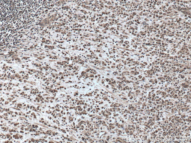 TOB1 Antibody in Immunohistochemistry (Paraffin) (IHC (P))