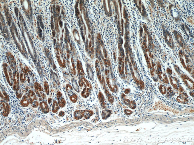 TOB1 Antibody in Immunohistochemistry (Paraffin) (IHC (P))