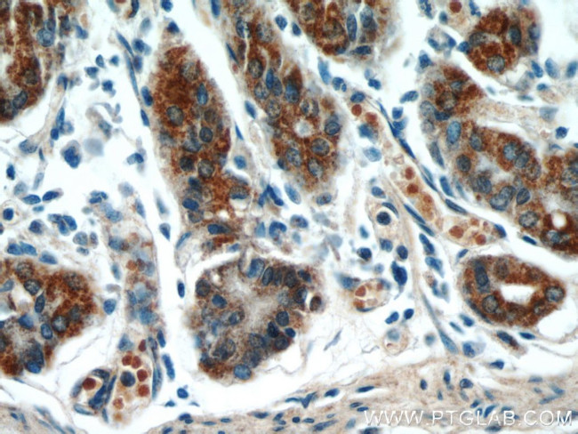 TOB1 Antibody in Immunohistochemistry (Paraffin) (IHC (P))