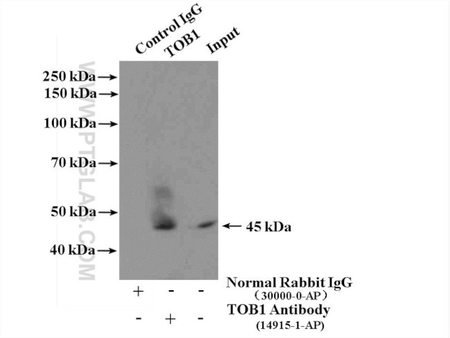 TOB1 Antibody in Immunoprecipitation (IP)