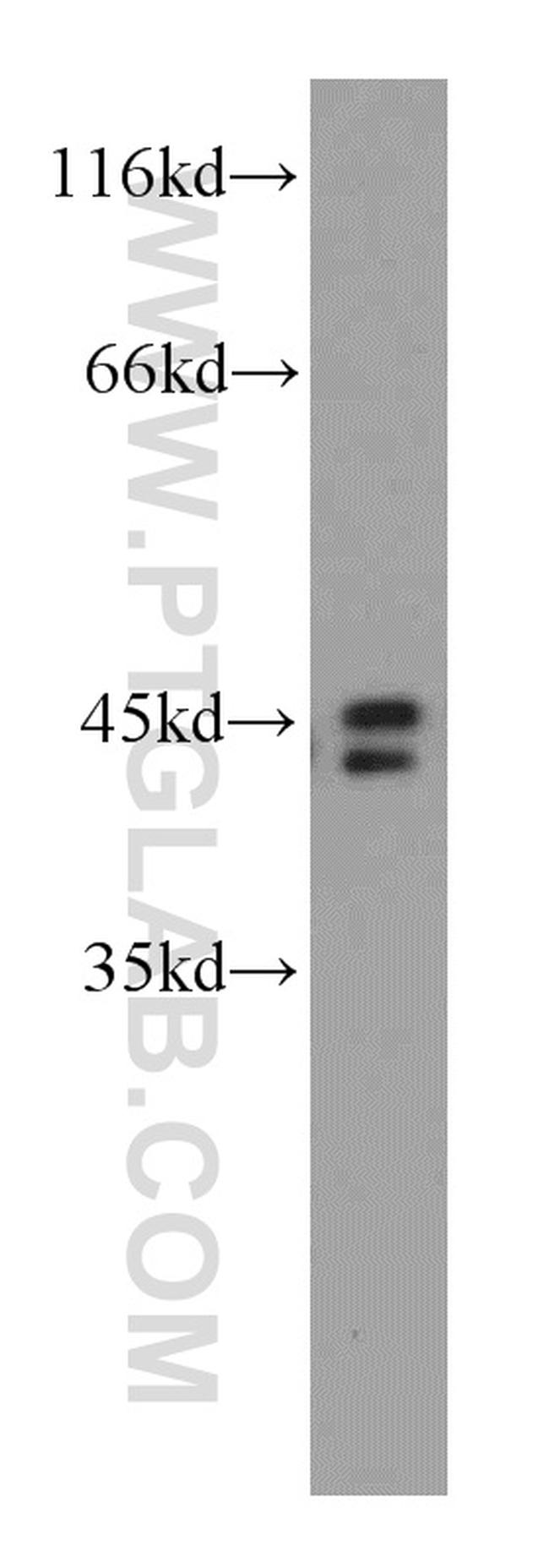 TOB1 Antibody in Western Blot (WB)