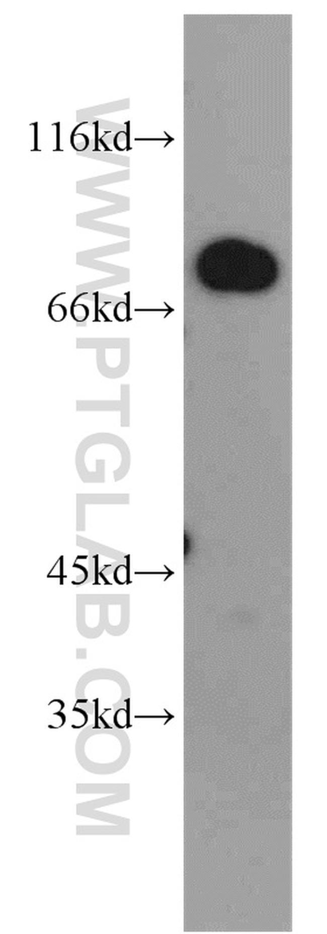 MEPCE Antibody in Western Blot (WB)