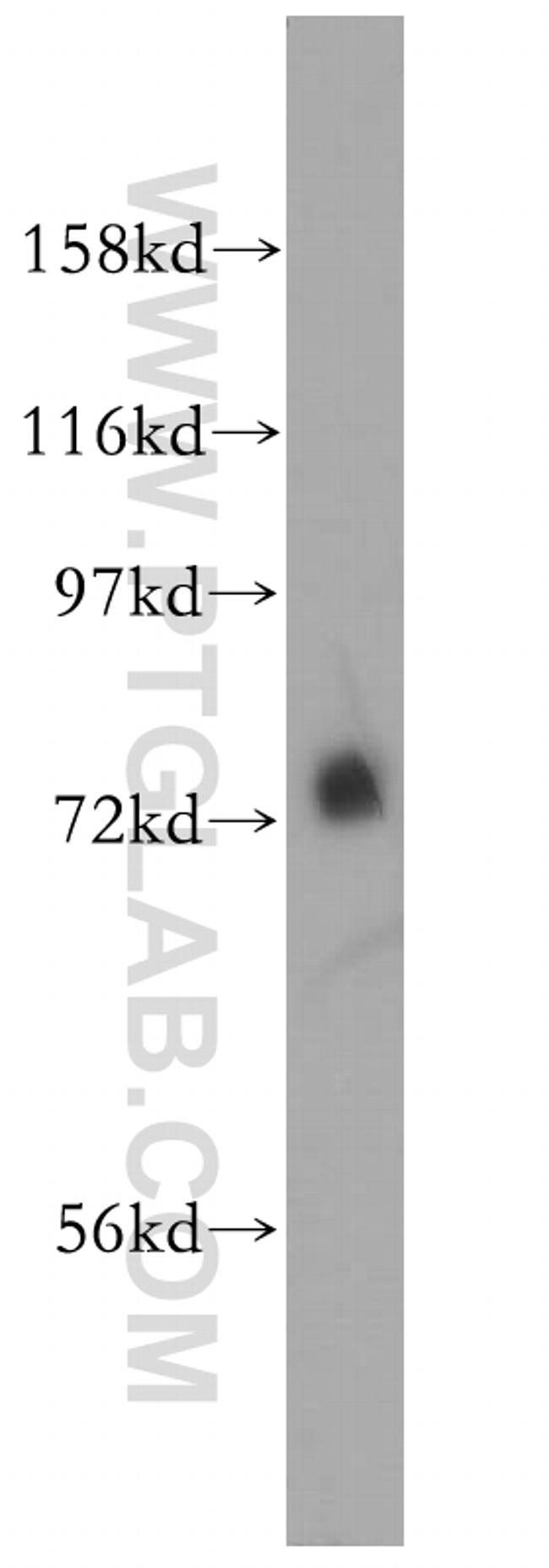 MEPCE Antibody in Western Blot (WB)