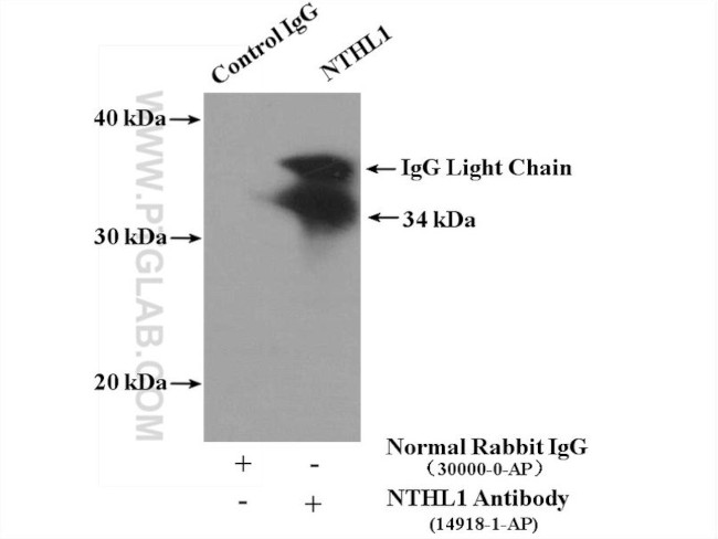 NTHL1 Antibody in Immunoprecipitation (IP)