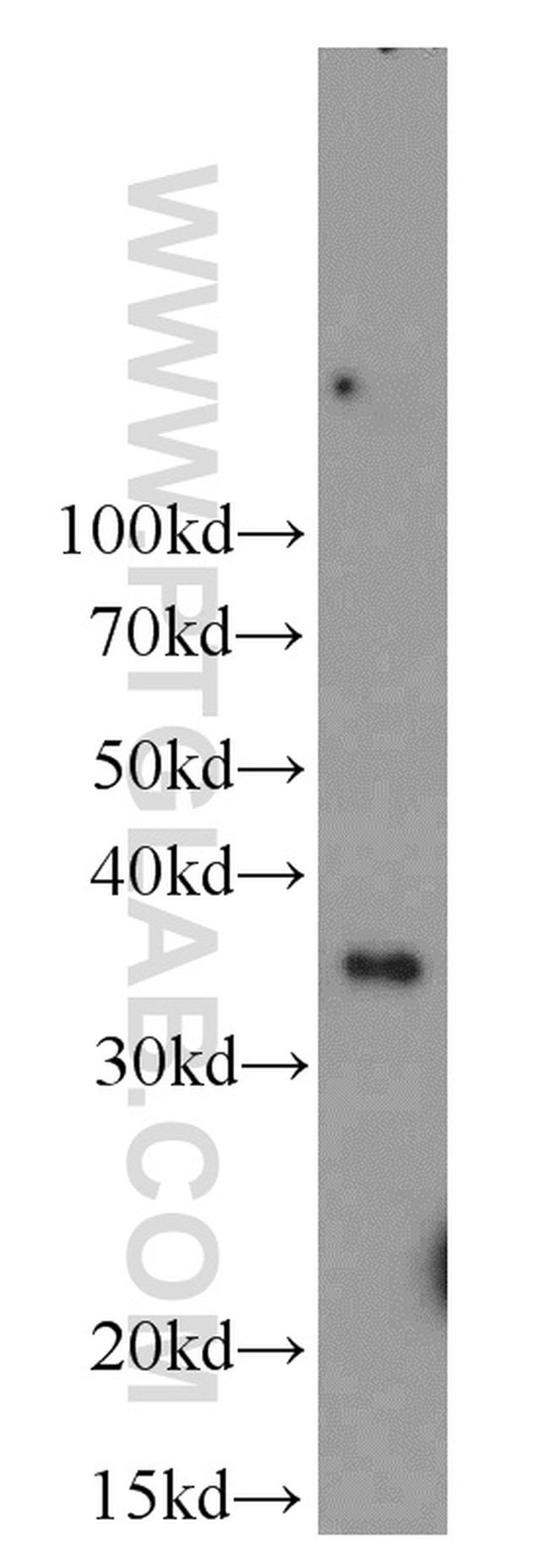 NTHL1 Antibody in Western Blot (WB)