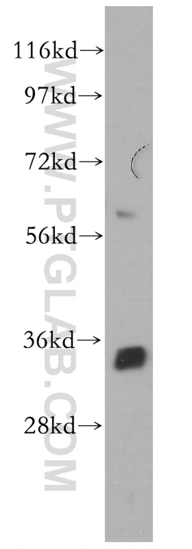 NTHL1 Antibody in Western Blot (WB)