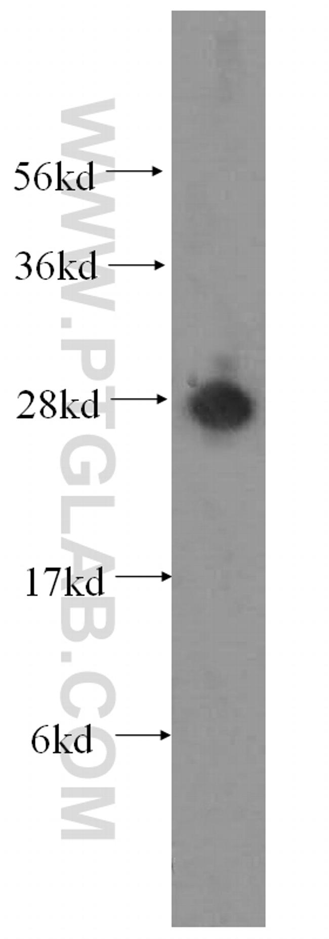 ATP6V1D Antibody in Western Blot (WB)