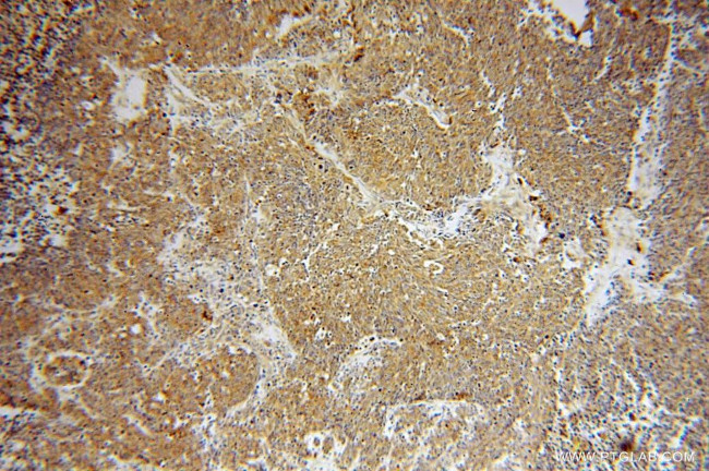 ATP6V1D Antibody in Immunohistochemistry (Paraffin) (IHC (P))