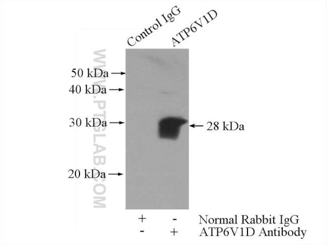 ATP6V1D Antibody in Immunoprecipitation (IP)