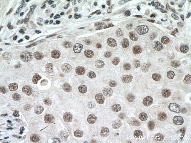 THUMPD1 Antibody in Immunohistochemistry (Paraffin) (IHC (P))