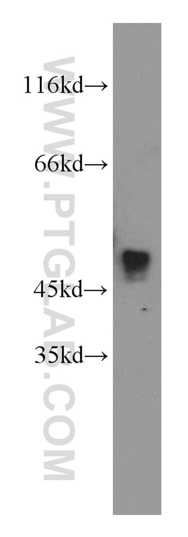 THUMPD1 Antibody in Western Blot (WB)