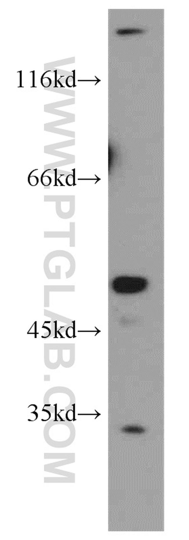 THUMPD1 Antibody in Western Blot (WB)