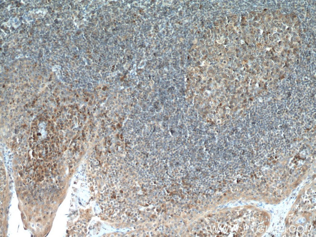 ICOSLG Antibody in Immunohistochemistry (Paraffin) (IHC (P))