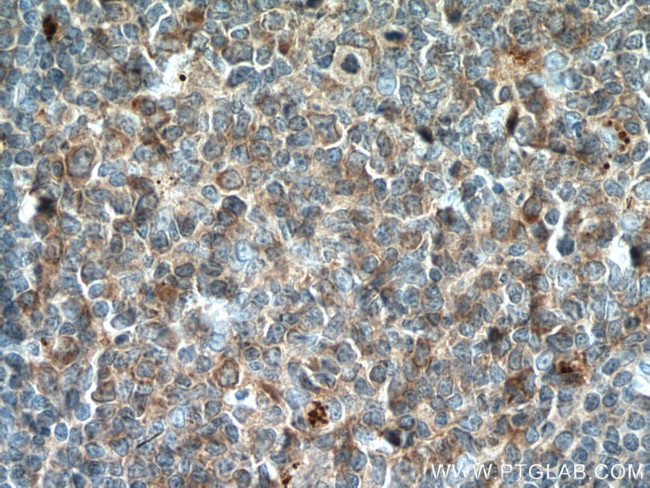 ICOSLG Antibody in Immunohistochemistry (Paraffin) (IHC (P))