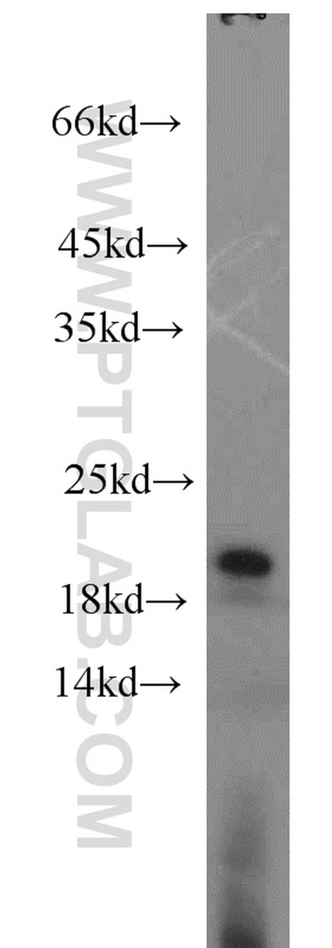 TIM22 Antibody in Western Blot (WB)