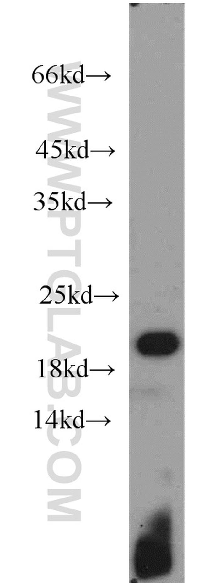 TIM22 Antibody in Western Blot (WB)