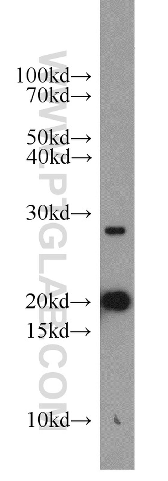 TIM22 Antibody in Western Blot (WB)