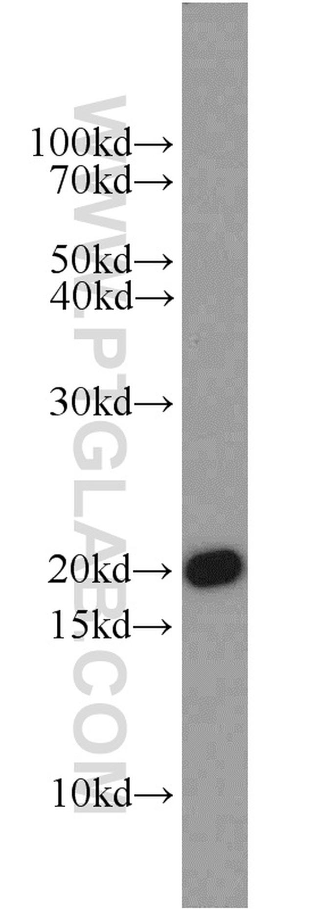 TIM22 Antibody in Western Blot (WB)