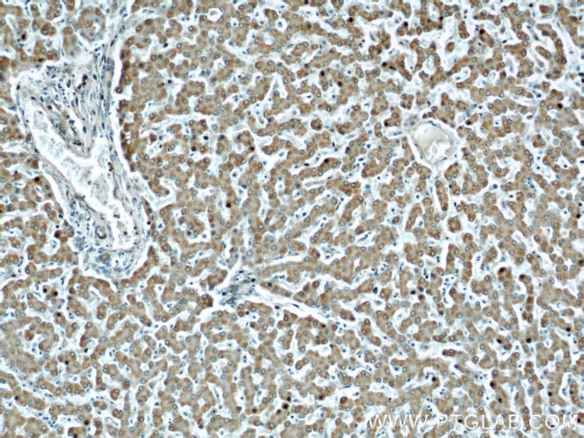 TIM22 Antibody in Immunohistochemistry (Paraffin) (IHC (P))