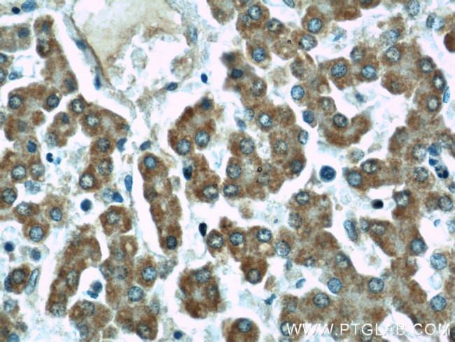 TIM22 Antibody in Immunohistochemistry (Paraffin) (IHC (P))